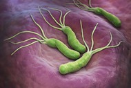     (H. pylori) IgG 